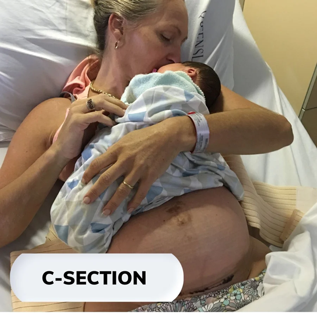 Woman holding new born baby with c-section belly band